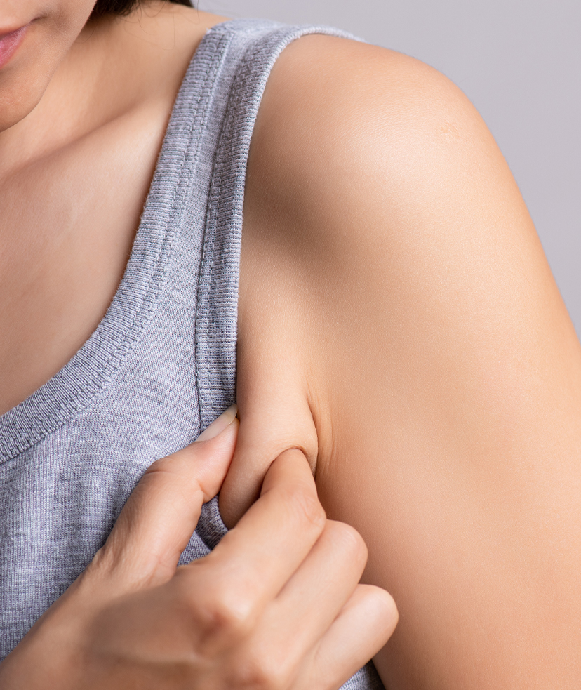 Woman pinching the skin on her arm.